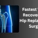 hip replacement surgery