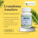 Herbal Supplements for Granuloma Annulare