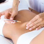 Injection Lipolysis Treatment