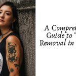 A Comprehensive Guide to Tattoo Removal in Kolkata