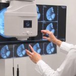 mammography test price