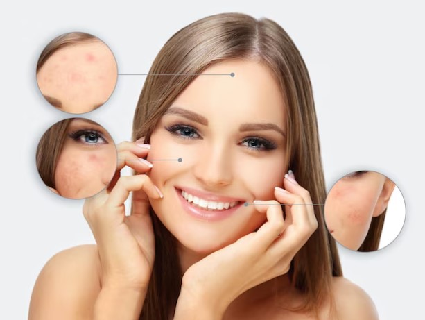 skin pigmentation treatment